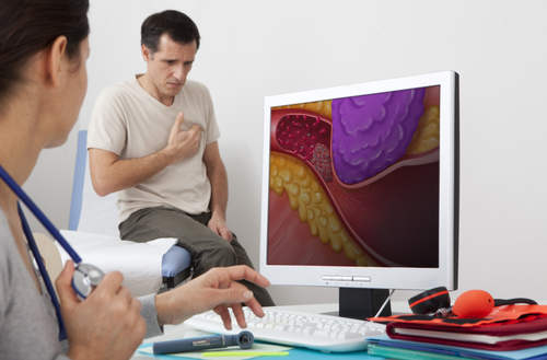 Onödiga dödsfall kan förebyggas med ökad kunskap om blodproppar (trombos)